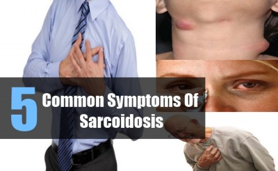 Common-Symptoms-Of-Sarcoidosis