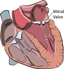 left ventricle illustration