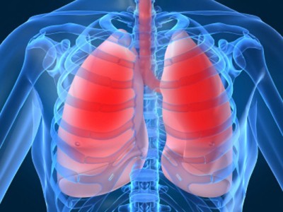 tuberculosis -lung