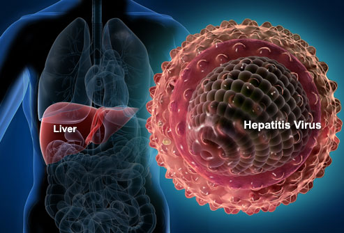 این ویروس یکی از انواع مختلف ویروس‌های هپاتیت است که باعث التهاب می‌شود و بر توانایی عملکردی کبد تاثیر می‌گذارد