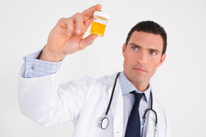 مونه حاصل از ادرار در آزمایشگاه برای حضور این عفونت تجزیه و تحلیل میشود