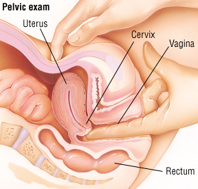 دکتر بصورت دستی نواحی خاصی از لگن‌تان را لمس می‌کند تا به اختلالاتی مانند کیست در ارگان تولیدمثلی و یا زخم در پشت رحم پی ببرد